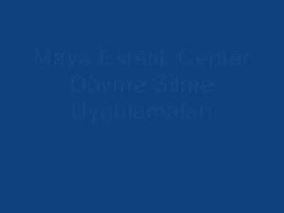 Maya Estetik Lazerle Dövme Silme Uygulama izle